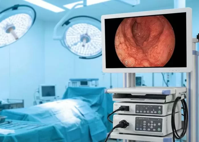 endoscopia
